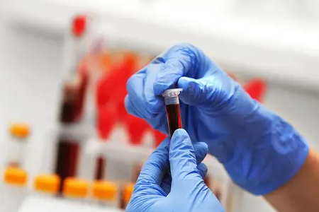 BABIO lance un test rapide de grossesse bovine par fluorescence