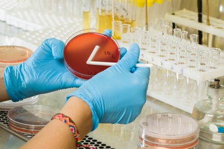 Milieu MacConkey Agar Medium de BABIO – Isolation sélective haut de gamme pour les diagnostics microbiologiques mondiaux