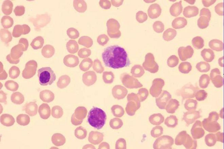 Brosse cervicale de cytologie stérile jetable BABIO pour un dépistage fiable de la santé des femmes